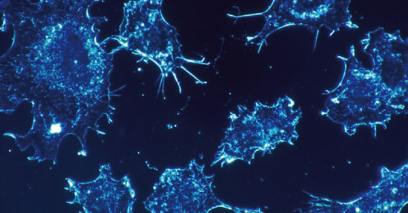 CIK、DC/CIK（PB）技术